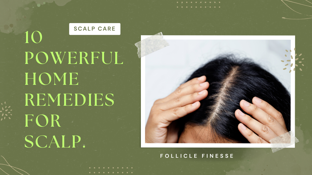 10 powerful home remedies for Scalp.